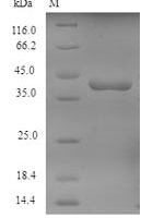 Human Tyrosine-protein kinase JAK1 (Jak1), partial Recombinant Protein - BioCrest Sci