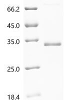 Macaca fascicularis Lymphotoxin beta receptor (LTBR), partial Recombinant Protein - BioCrest Sci