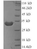 Mouse B-lymphocyte antigen CD20 (Ms4a1), partial Recombinant Protein, N-His-SUMO - BioCrest Sci
