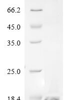 Conus striatus Con-ikot-ikot Recombinant Protein, N-His, aa 38–123, E.coli - BioCrest Sci