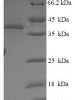 Human SOSS complex subunit B2 (OBFC2A) Recombinant Protein - BioCrest Sci