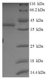 Human SOSS complex subunit B2 (OBFC2A) Recombinant Protein, Homo sapiens (Human), E.coli, N-terminal 6xHis-SUMO-tagged, 38.4 kDa, purity >≥ 90% as determined by SDS-PAGE.