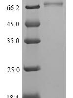 Mouse Isthmin-1 (Ism1) Recombinant Protein, Tag-Free - BioCrest Sci