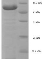 Mouse Lysyl oxidase homolog 1 (Loxl1) Recombinant Protein, N-His, aa 95–607, E.coli - BioCrest Sci