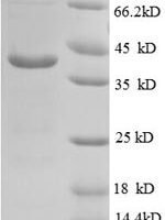 Human V-type proton ATPase subunit G 1 (ATP6V1G1) Recombinant Protein - BioCrest Sci