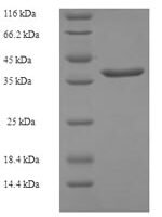 Human Cysteine-rich protein 2 (CRIP2) Recombinant Protein - BioCrest Sci