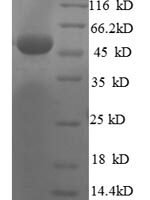Human 60S ribosomal protein L8 (RPL8), partial Recombinant Protein - BioCrest Sci