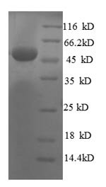 Human 60S ribosomal protein L8 (RPL8), partial Recombinant Protein, Homo sapiens (Human), E.coli, N-terminal GST-tagged, 54.8 kDa, purity >≥ 90% as determined by SDS-PAGE.