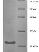 Hadronyche versuta Omega-hexatoxin-Hv1a Recombinant Protein - BioCrest Sci