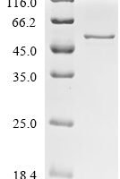 Human Histone acetyltransferase type B catalytic subunit (HAT1) Recombinant Protein - BioCrest Sci