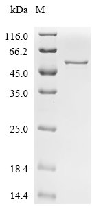 Human Histone acetyltransferase type B catalytic subunit (HAT1) Recombinant Protein, Homo sapiens (Human), E.coli, C-terminal 6xHis-tagged, 56.3 kDa, purity >≥ 90% as determined by SDS-PAGE.
