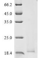 Influenza A virus Matrix protein 2 (M2), partial Recombinant Protein - BioCrest Sci