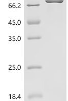 Rat 
Protein-arginine deiminase type-2 (Padi2) Recombinant Protein - BioCrest Sci