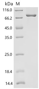 Rat
Protein-arginine deiminase type-2 (Padi2) Recombinant Protein, Rattus norvegicus (Rat), Mammalian cell, C-terminal 10xHis-tagged, 76.7 kDa, purity >≥ 95% as determined by SDS-PAGE.
