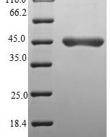 Human NEDD8-conjugating enzyme UBE2F (UBE2F) Recombinant Protein - BioCrest Sci