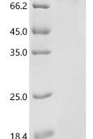 Human Endoplasmin (HSP90B1) Recombinant Protein - BioCrest Sci