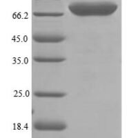 Rat Transferrin receptor protein 2 (Tfr2), partial Recombinant Protein - BioCrest Sci