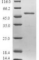 Human Spindlin-2B (SPIN2B) Recombinant Protein - BioCrest Sci