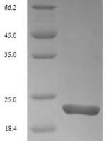 Mouse Triggering receptor expressed on myeloid cells 2 (Trem2), partial Recombinant Protein, N-His - BioCrest Sci