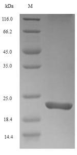 Mouse Triggering receptor expressed on myeloid cells 2 (Trem2), partial Recombinant Protein, N-His, Mus musculus (Mouse), E.coli, N-terminal 6xHis-tagged, 20.8 kDa, purity >≥ 90% as determined by SDS-PAGE.