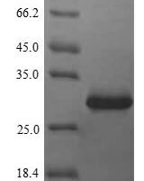 Human Cyclin-dependent kinase inhibitor 3 (CDKN3) Recombinant Protein - BioCrest Sci