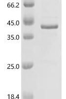 Human Pendrin (SLC26A4), partial Recombinant Protein, C-His, aa 586–780 - BioCrest Sci