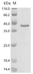 Human Pendrin (SLC26A4), partial Recombinant Protein, C-His, aa 586–780, Homo sapiens (Human), Baculovirus, C-terminal 6xHis-tagged, 27.6 kDa, purity >≥ 85% as determined by SDS-PAGE.