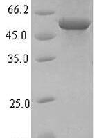 Influenza A virus Hemagglutinin (HA), partial Recombinant Protein, N-His-SUMO, aa 18–343 - BioCrest Sci