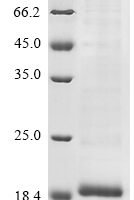 Avian infectious bronchitis virus Non-structural protein 5a (5a) Recombinant Protein, N-His-SUMO - BioCrest Sci