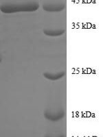 Human Sorting nexin-3 (SNX3) Recombinant Protein - BioCrest Sci