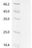 Human Bone morphogenetic protein 1 (BMP1) Recombinant Protein, C-His - BioCrest Sci