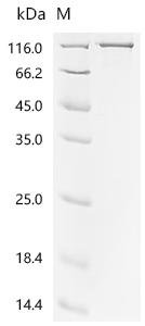 Human Bone morphogenetic protein 1 (BMP1) Recombinant Protein, C-His, Homo sapiens (Human), E.coli, C-terminal 6xHis-tagged, 105 kDa, purity >≥ 85% as determined by SDS-PAGE.
