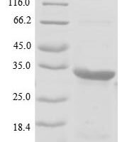 Pig Rhodopsin (RHO), partial Recombinant Protein, N-His-GST - BioCrest Sci