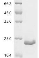 Human Synaptic vesicle glycoprotein 2C (SV2C), partial Recombinant Protein, C-His, aa 459–578, E.coli - BioCrest Sci
