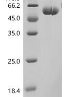 Macaca fascicularis Interleukin-6(IL6) Recombinant Protein, C-hFc1 - BioCrest Sci
