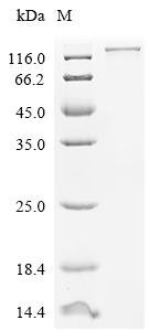 Human NAD(+) hydrolase SARM1 (SARM1) Recombinant Protein, C-10His-HSA, Homo sapiens (Human), Mammalian cell, C-terminal 10xHis-HSA-tagged, 144.5 kDa, purity >≥ 85% as determined by SDS-PAGE.