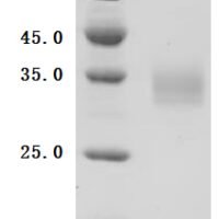 Human Galectin-3 (LGALS3) Recombinant Protein - BioCrest Sci