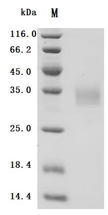 Human Galectin-3 (LGALS3) Recombinant Protein, Homo sapiens (Human), Mammalian cell, C-terminal 10xHis-tagged, 28.9 kDa, purity >≥ 95% as determined by SDS-PAGE.