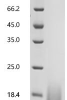 Mouse Gastric inhibitory polypeptide (Gip), partial Recombinant Protein, C-10His - BioCrest Sci