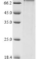 Rat Mannan-binding lectin serine protease 2 (Masp2) Recombinant Protein, C-10His - BioCrest Sci