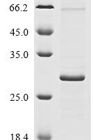 Human coronavirus HKU1 Protein I (N) Recombinant Protein, N-10His/C-Myc - BioCrest Sci