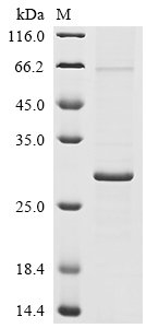 Human coronavirus HKU1 Protein I (N) Recombinant Protein, N-10His/C-Myc, Human coronavirus HKU1 (isolate N1) (HCoV-HKU1), E.coli, N-terminal 10xHis-tagged and C-terminal Myc-tagged, 27.8 kDa, purity >≥ 85% as determined by SDS-PAGE.