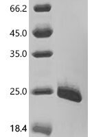 Human Fibronectin type III domain-containing protein 4 (FNDC4), partial Recombinant Protein - BioCrest Sci