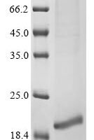 Human Neurotrophin-3 (NTF3) Recombinant Protein, N-10His/C-Myc, aa 139–257, Mammalian cell - BioCrest Sci