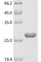 Anopheles gambiae AGAP008055-PA (CSP3) Recombinant Protein - BioCrest Sci