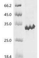 Candida albicans Hyphally regulated cell wall protein 1 (HYR1), partial Recombinant Protein - BioCrest Sci