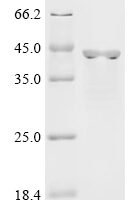 Pig Aldo-keto reductase family 1 member A1 (AKR1A1) Recombinant Protein - BioCrest Sci