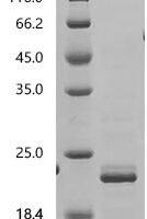 Human Seizure protein 6 homolog (SEZ6), partial Recombinant Protein, C-10His, aa 415–527, E.coli - BioCrest Sci