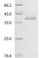 Bovine Regakine-1 Recombinant Protein, C-hFc1 - BioCrest Sci
