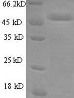Human Cytochrome b-c1 complex subunit Rieske, mitochondrial (UQCRFS1) Recombinant Protein - BioCrest Sci